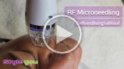 RFMicroneedling_quer